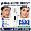 Espátula Ultrasónica Facial GUGUG – Limpiador Profundo + Removedor de Impurezas SkinClean Pro – Espátula Ultrasónica Facial