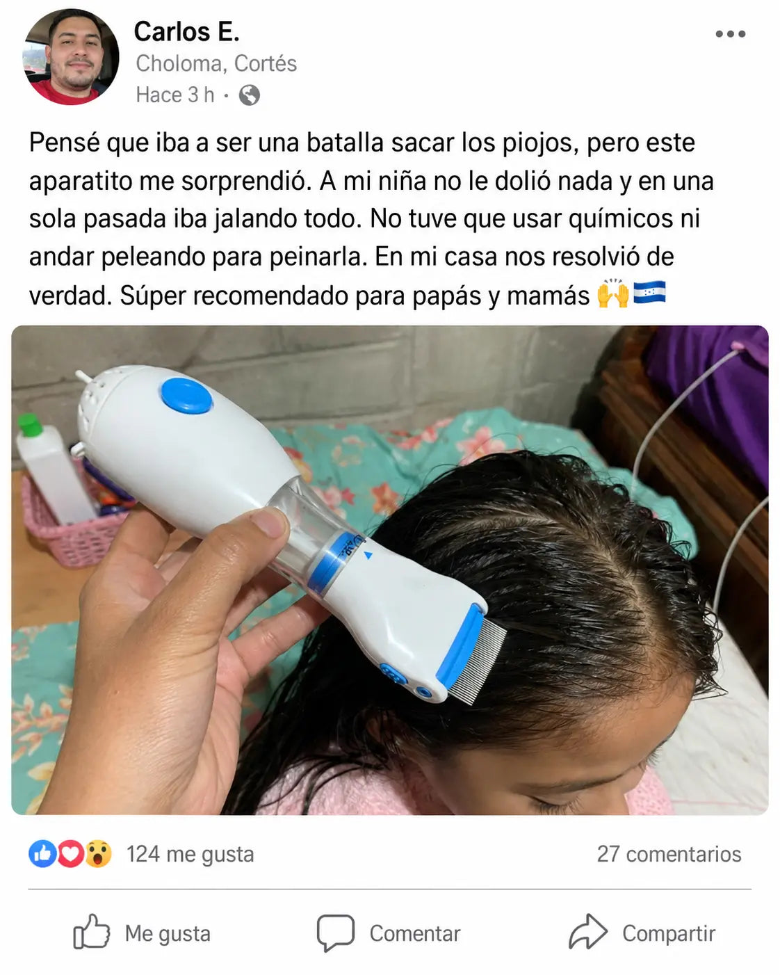 LiceOff Pro | Eliminador Eléctrico de Piojos y Liendres con Succión y Peine Acero Inoxidable | Sin Químicos | Luz LED | Seguro para Niños y Adultos | Pago al Recibir Honduras